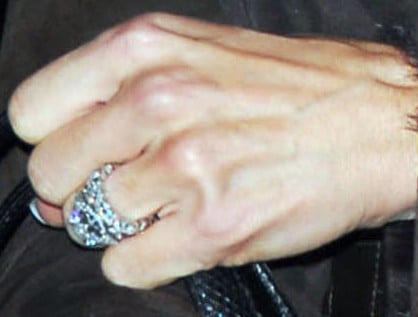 Forum wedding ring
