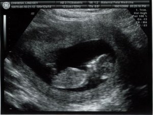 12w1d_baby1.JPG