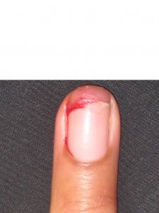 NailNoNo2.JPG NailNoNo2.JPG