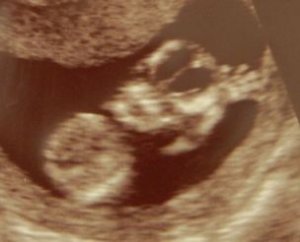 12w5d-2crop1.jpg