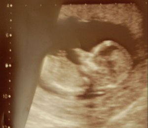 12w5d-3crop1.jpg