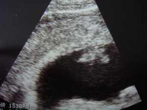 babylove 005.jpg