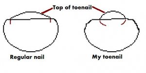 toenail.JPG