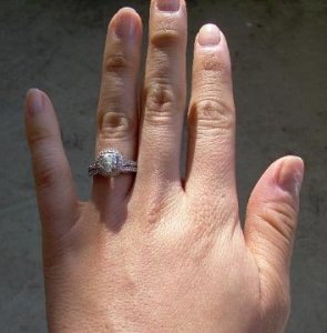 ring1-1yyyy.jpg