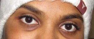bbo_eyes.jpg