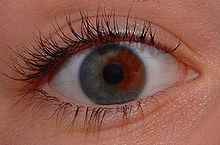 HeterochromiaEyepicforps.jpg