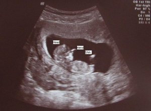 11w5d with labels.JPG