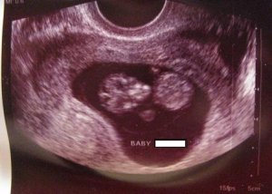 Baby Compressed Web.JPG