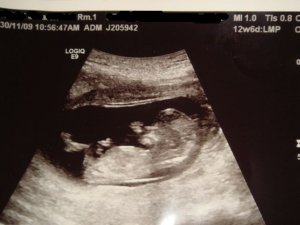 PSbaby13w.jpg