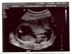 Baby13weeksNetPic.jpg