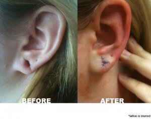 earcompare1.jpg earcompare1.jpg