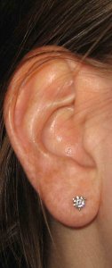 ear12112.jpg