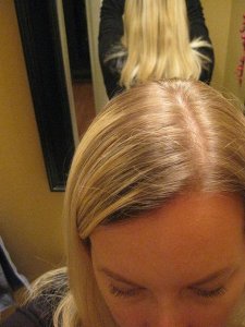 hairroots.jpg