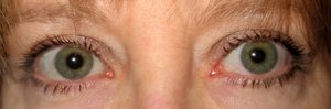 Eyes_1.jpg