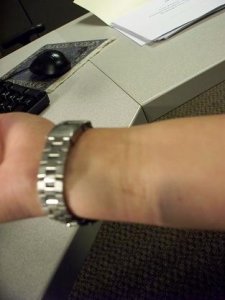 wrist hh.JPG