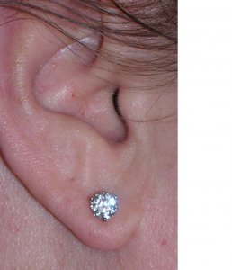 DIAon the ear.JPG