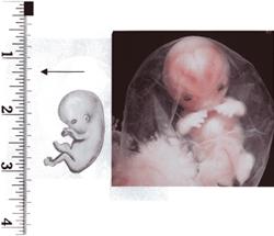10 week embryo.jpg