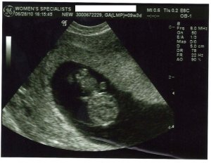 HMG9weeks3daysUS.jpg