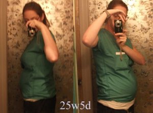 25w5dlynnie.jpg