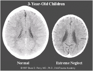 child brain.gif