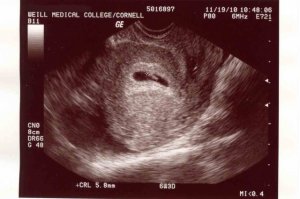 Ultrasound-11-19-10-pic1web.jpg