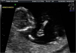 Turtle12wk.jpg