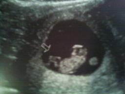 US - 8w6d.jpg