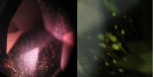 comparison_Alex_demantoid_30x_2.JPG