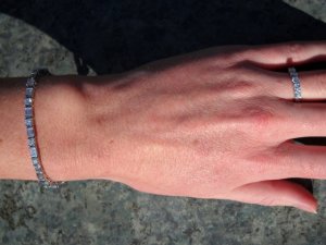 BraceletOn.jpg BraceletOn.jpg