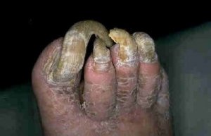 1ugly-feet.jpg
