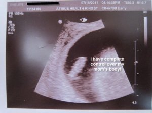 first ultrasound4.jpg