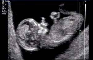 littleminione12wks.jpg