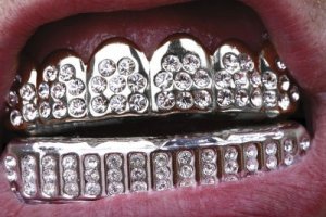 diamond-grill-kh102410.jpg