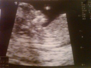 12 weeks..jpg
