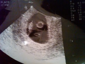 6 weeks.jpg