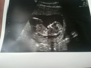 4.3.12.jpg