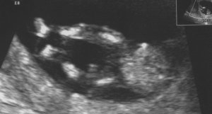 baby legs 3216546.jpg