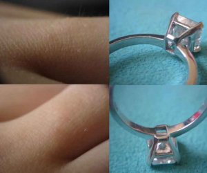 ring problems.jpg