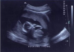 ultrasound6.jpg