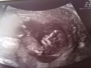12 week scan 2.jpg