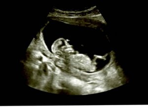 BabyBranch.jpg