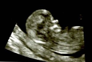 BabyBranch4.jpg