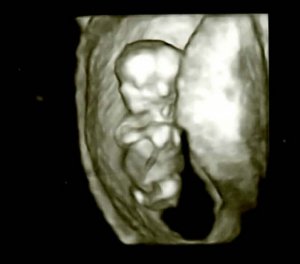 BabyBranch2.jpg