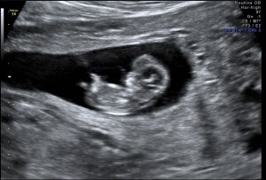 baby_pics_01212013_6.jpg