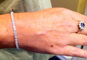 wrist2.jpg wrist2.jpg