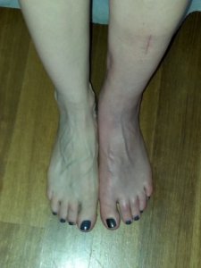 yukkylegcomparison.jpg