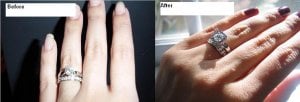 beforeaftermetroring.JPG
