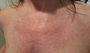 laser-chest-08242013-cropped.jpg
