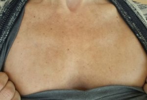 20150627_chest-cropped.jpg
