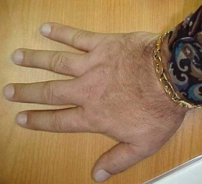 hand.JPG